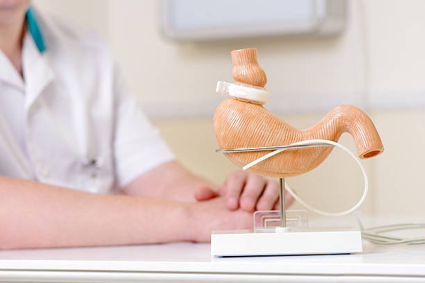 Bariatric Surgery