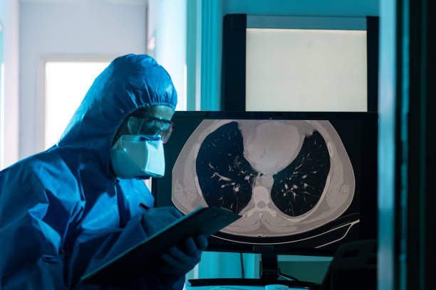 Radiation Therapy