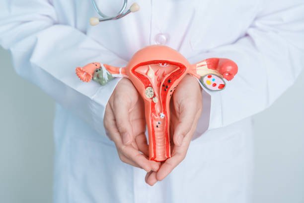 Hysterectomy
