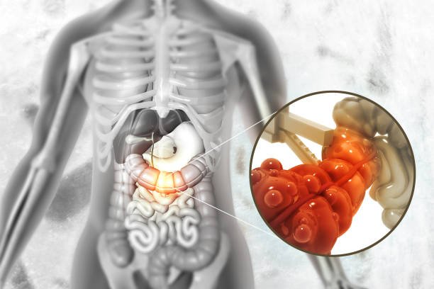 Laparoscopic Gynecological Surgery
